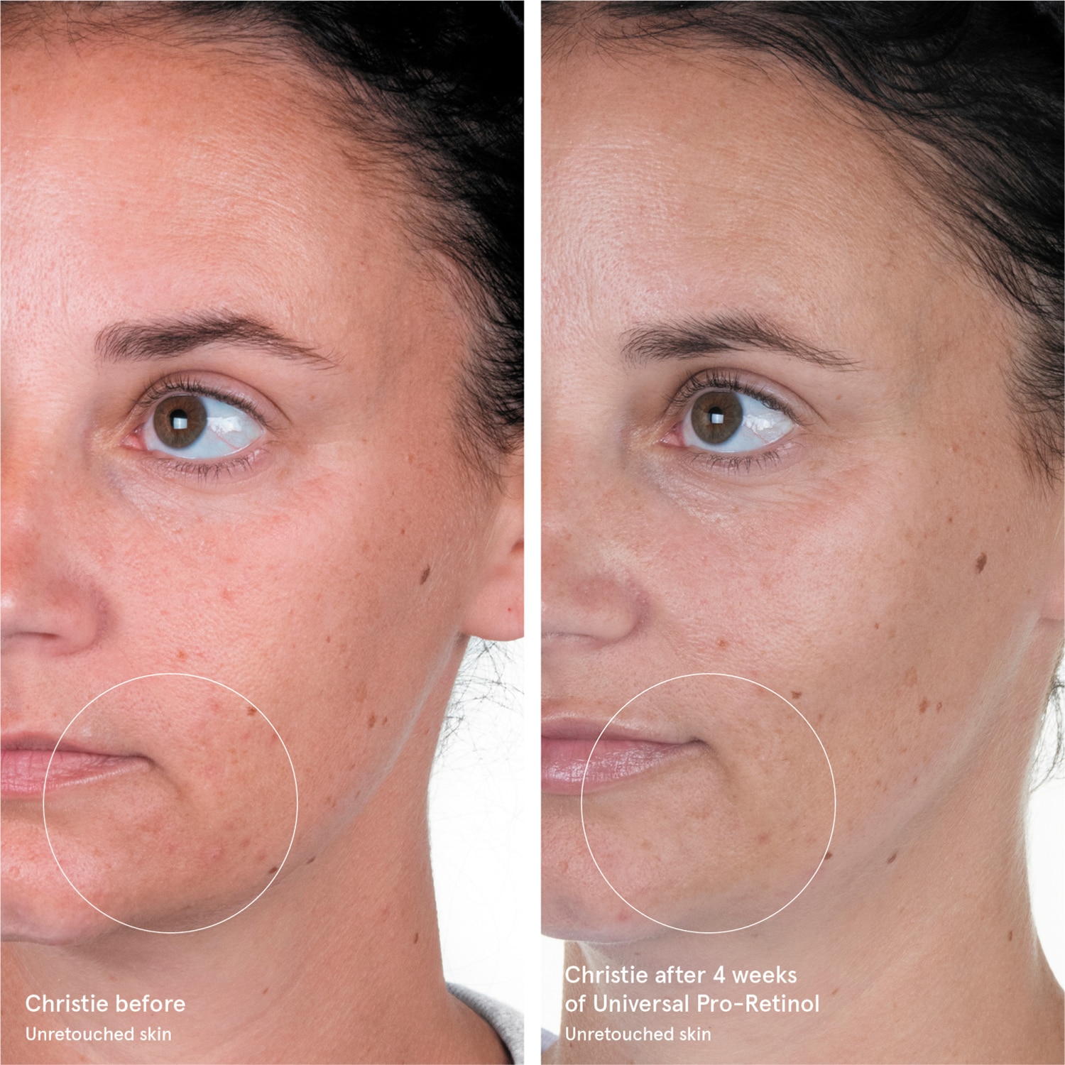 UNIVERSAL PRO-RETINOL OVERNIGHT RENEWING TREATMENT (TRATAMIENTO RENOVADOR DE NOCHE)